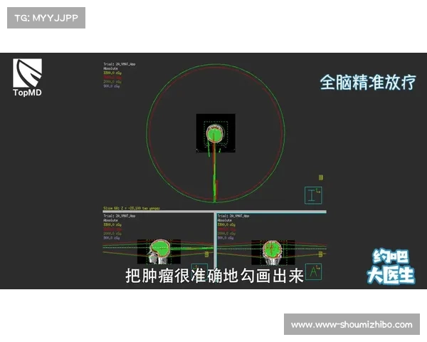 推杆技术解析与优化方法：提升高尔夫球员精准度与稳定性的关键技巧